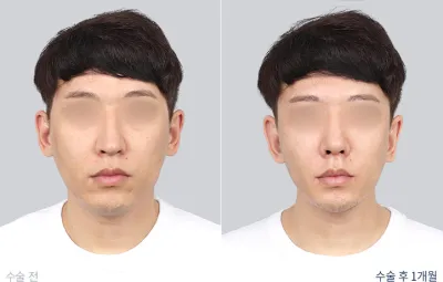 Before & After