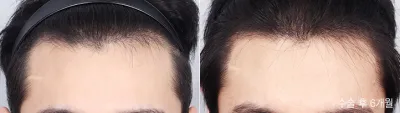 Before & After