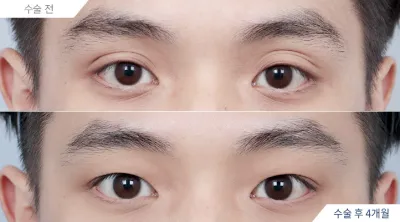Before & After