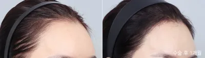Before & After