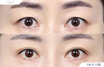 Before & After