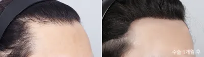 Before & After