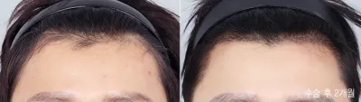 Before & After