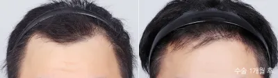Before & After
