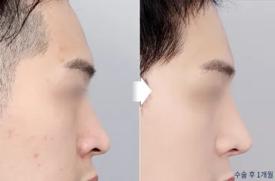 Before & After