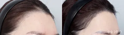 Before & After