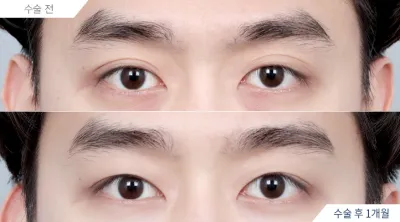 Before & After