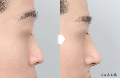 Before & After