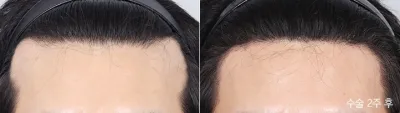 Before & After