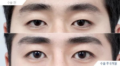 Before & After