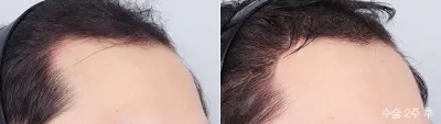 Before & After