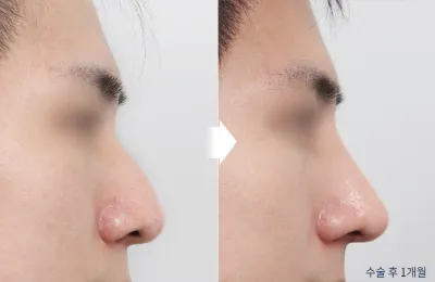 Before & After
