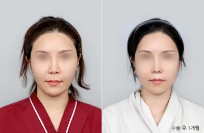 Before & After