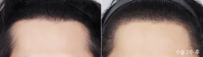 Before & After