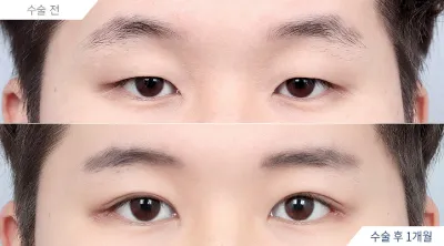 Before & After