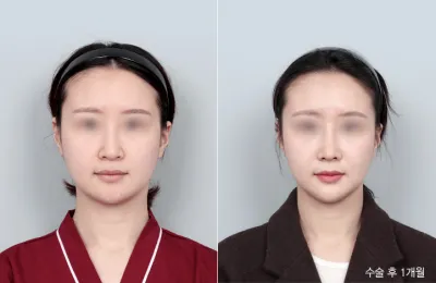 Before & After