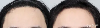 Before & After