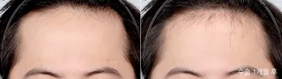 Before & After