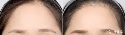 Before & After