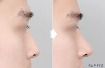 Before & After
