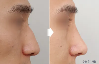 Before & After
