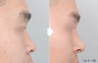 Before & After