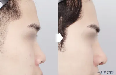 Before & After