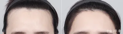 Before & After