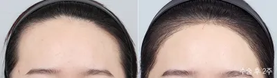 Before & After