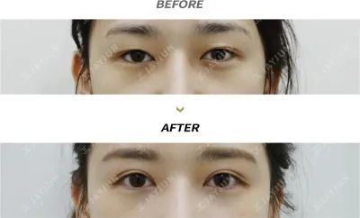 Before & After
