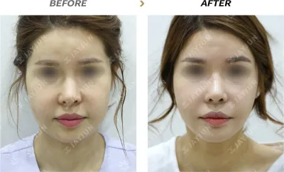 Before & After