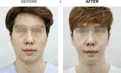 Before & After