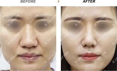 Before & After