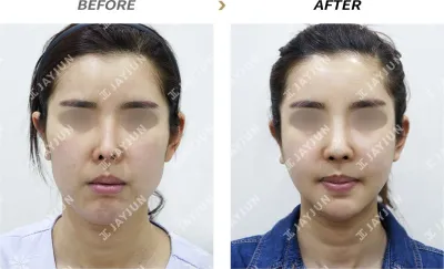 Before & After