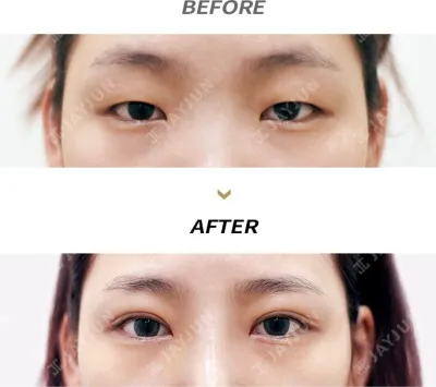 Before & After