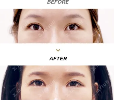 Before & After