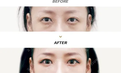 Before & After