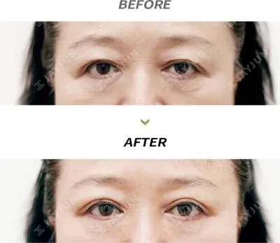 Before & After