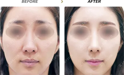 Before & After