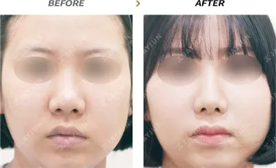 Before & After