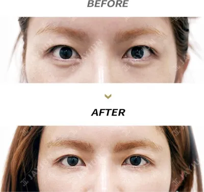 Before & After