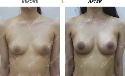 Before & After