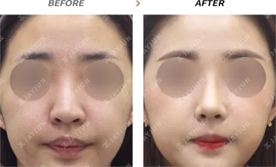 Before & After