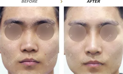 Before & After