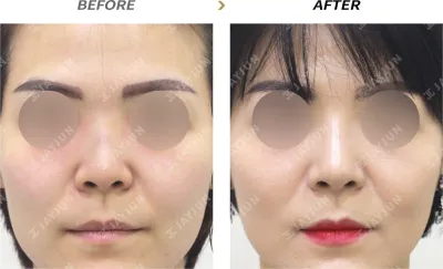 Before & After