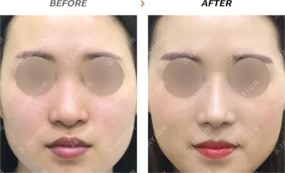 Before & After