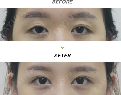 Before & After