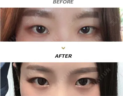 Before & After