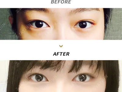 Before & After