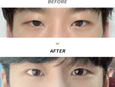 Before & After